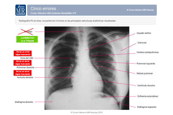 Ejercicio Cinco Errores