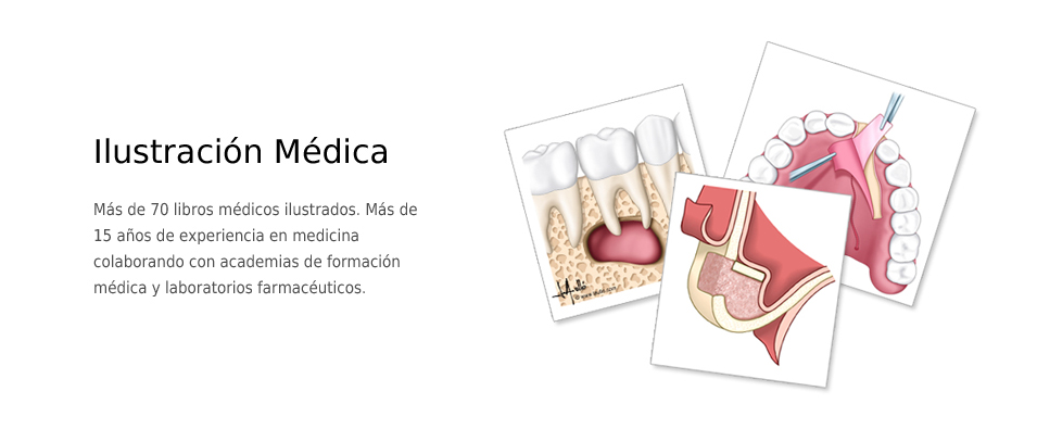 Ilustración médica