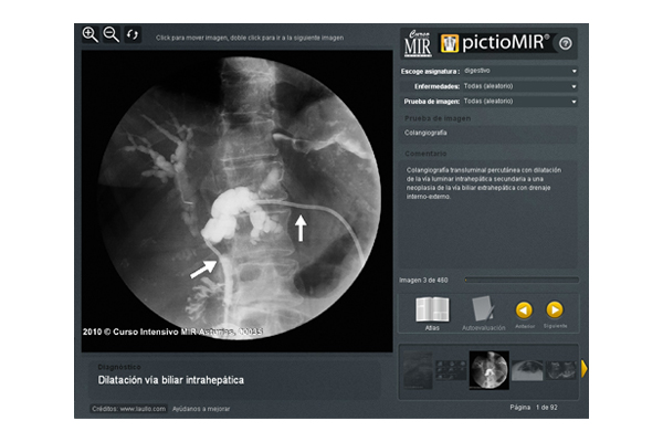 Interactivo visualizador de imágenes médicas pictioMIR