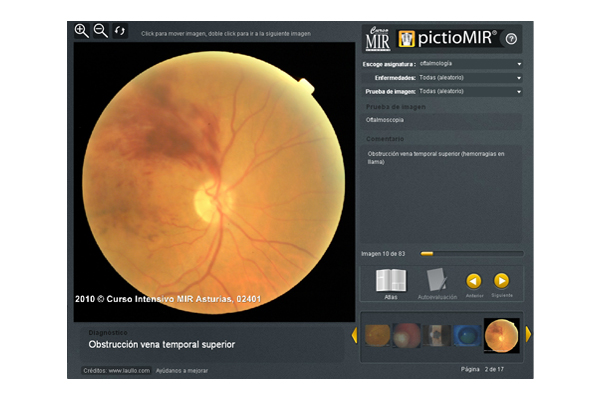 Interactivo visualizador de imágenes médicas pictioMIR